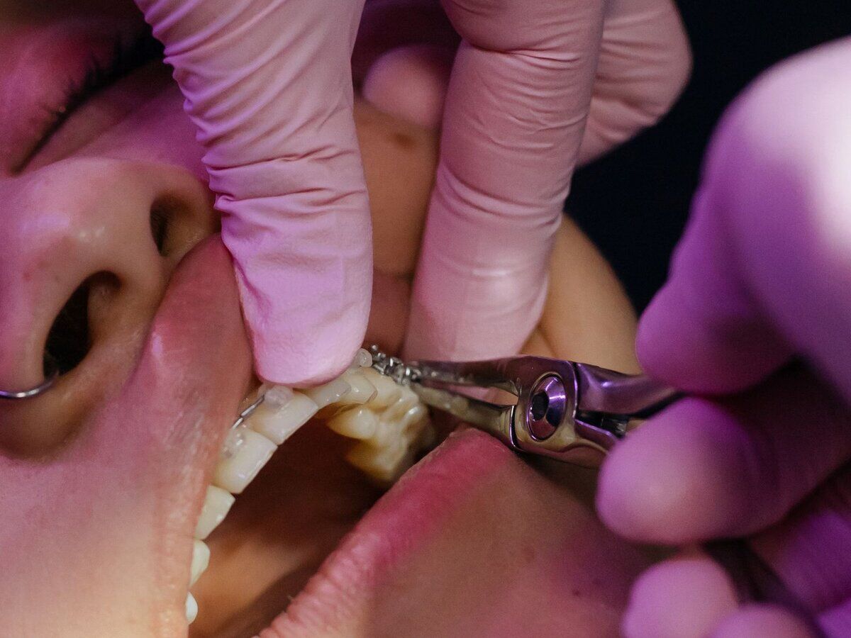 Examen des gencives à l'aide d'instruments dentaires