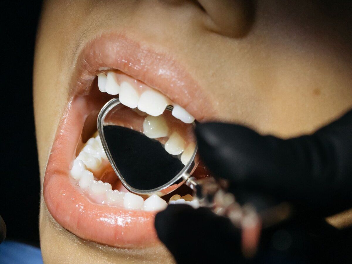 Examen dentaire d'un enfant à l'aide d'un miroir buccal